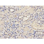 Immunohistochemistry - AP2B1 Antibody from Signalway Antibody (32542) - Antibodies.com