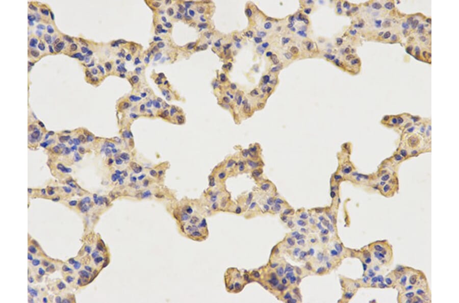 Immunohistochemistry - AP2B1 Antibody from Signalway Antibody (32542) - Antibodies.com