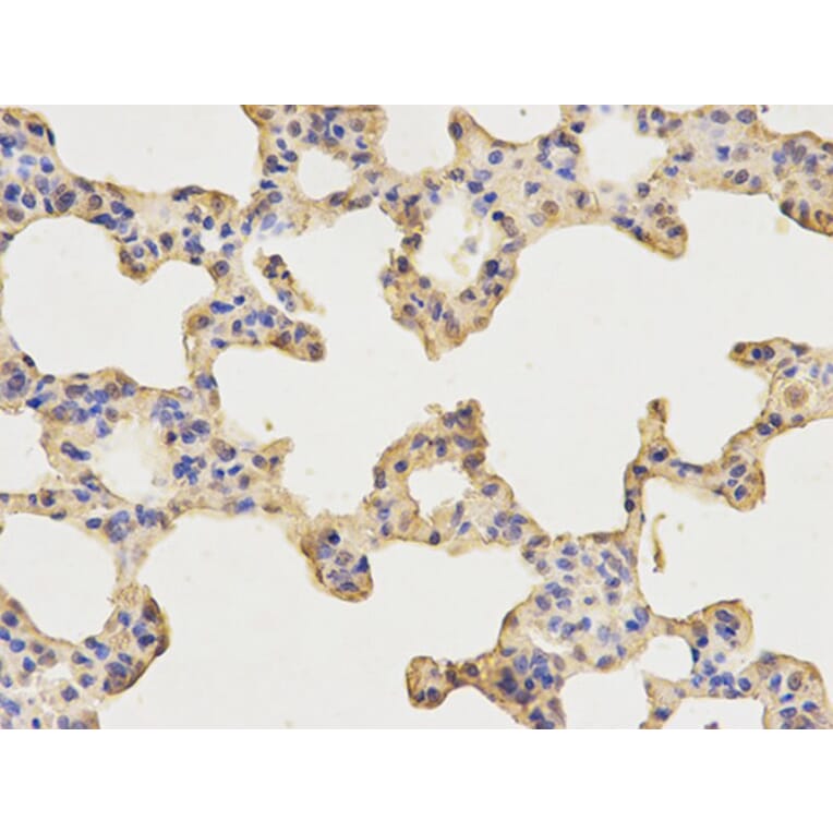 Immunohistochemistry - AP2B1 Antibody from Signalway Antibody (32542) - Antibodies.com