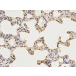 Immunohistochemistry - AP2B1 Antibody from Signalway Antibody (32542) - Antibodies.com