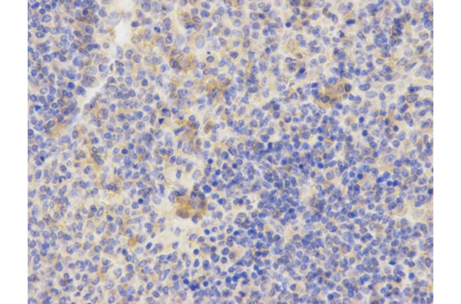 Immunohistochemistry - AP2B1 Antibody from Signalway Antibody (32542) - Antibodies.com
