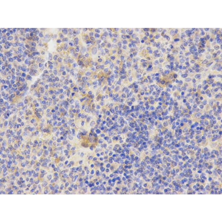 Immunohistochemistry - AP2B1 Antibody from Signalway Antibody (32542) - Antibodies.com