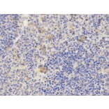 Immunohistochemistry - AP2B1 Antibody from Signalway Antibody (32542) - Antibodies.com