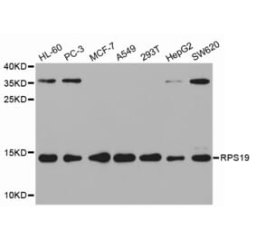 Western blot - RPS19 Antibody from Signalway Antibody (32553) - Antibodies.com