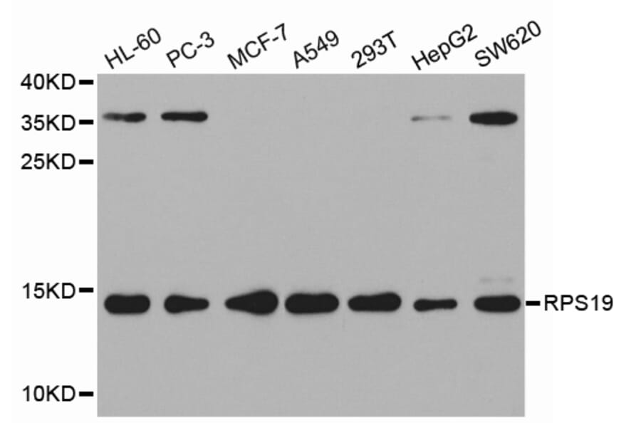Western blot - RPS19 Antibody from Signalway Antibody (32553) - Antibodies.com