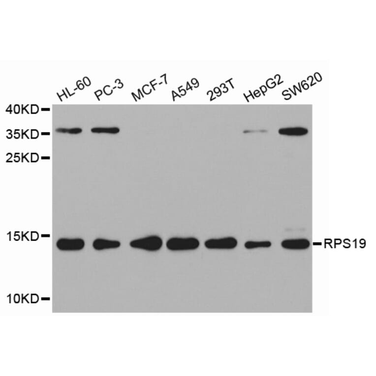 Western blot - RPS19 Antibody from Signalway Antibody (32553) - Antibodies.com