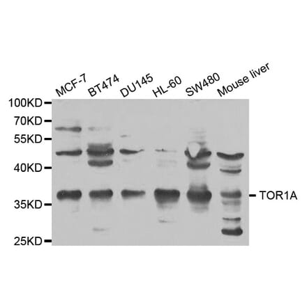 Western blot - TOR1A Antibody from Signalway Antibody (32581) - Antibodies.com