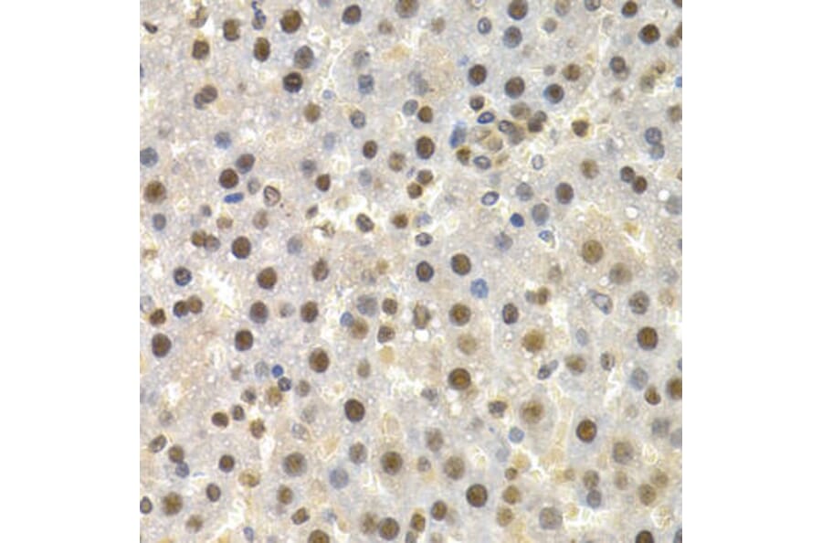 Immunohistochemistry - TOR1A Antibody from Signalway Antibody (32581) - Antibodies.com