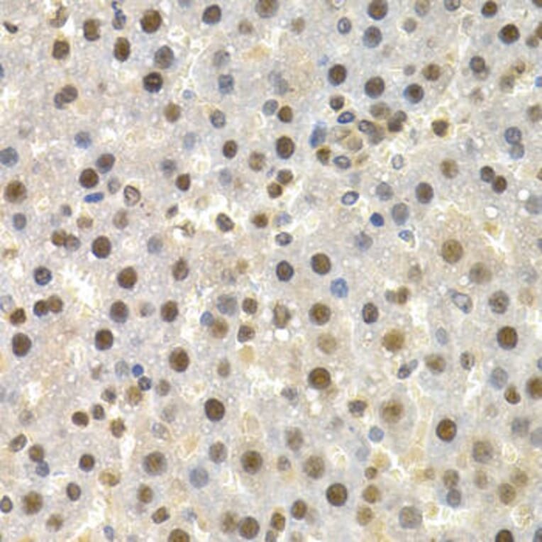 Immunohistochemistry - TOR1A Antibody from Signalway Antibody (32581) - Antibodies.com