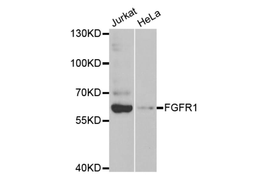 Western blot - FGFR1 Antibody from Signalway Antibody (32585) - Antibodies.com