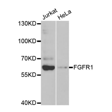 Western blot - FGFR1 Antibody from Signalway Antibody (32585) - Antibodies.com