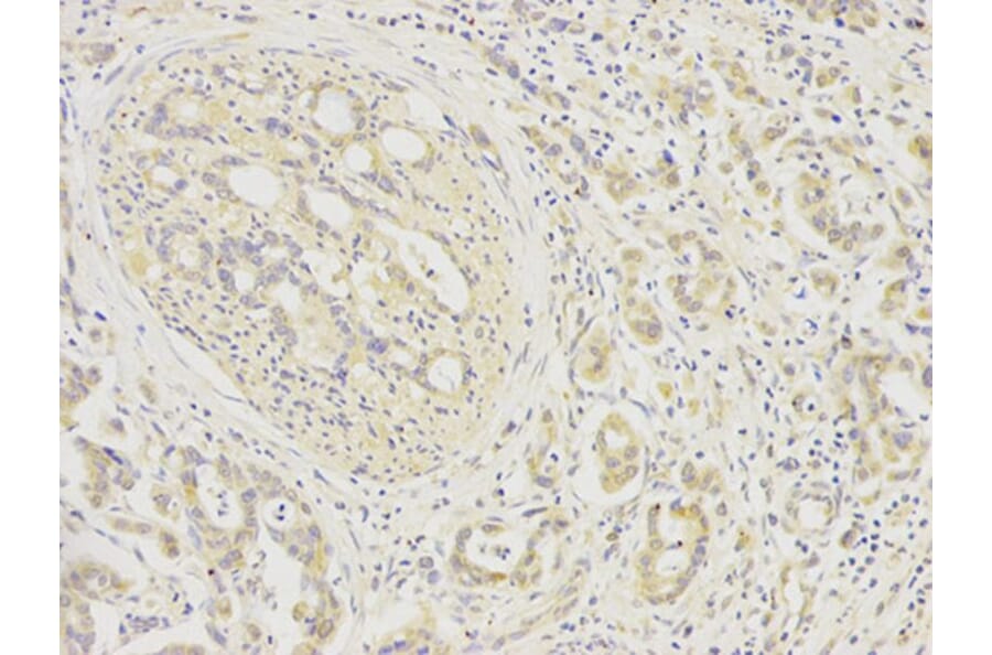 Immunohistochemistry - FGFR1 Antibody from Signalway Antibody (32585) - Antibodies.com