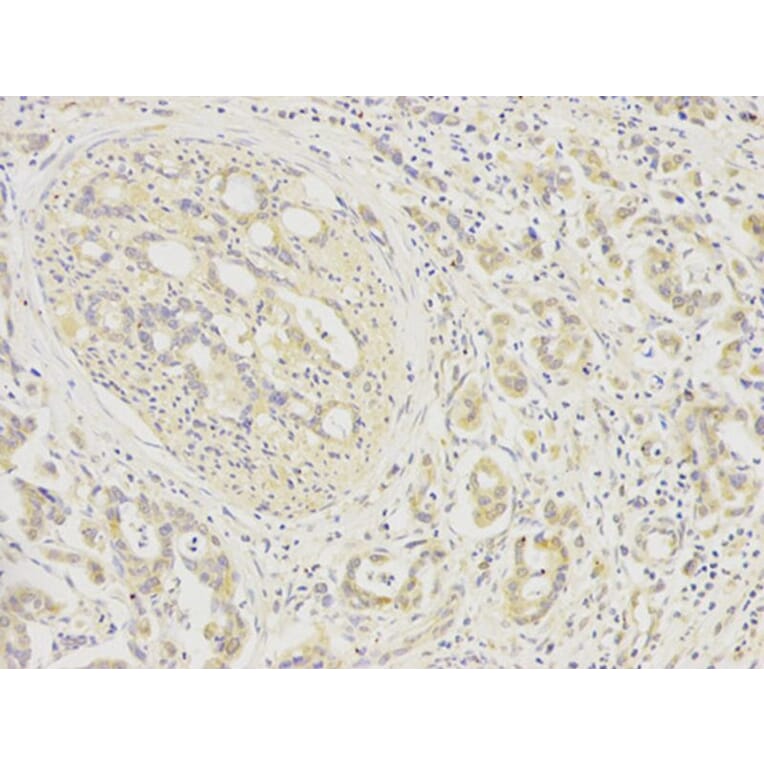 Immunohistochemistry - FGFR1 Antibody from Signalway Antibody (32585) - Antibodies.com