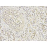 Immunohistochemistry - FGFR1 Antibody from Signalway Antibody (32585) - Antibodies.com