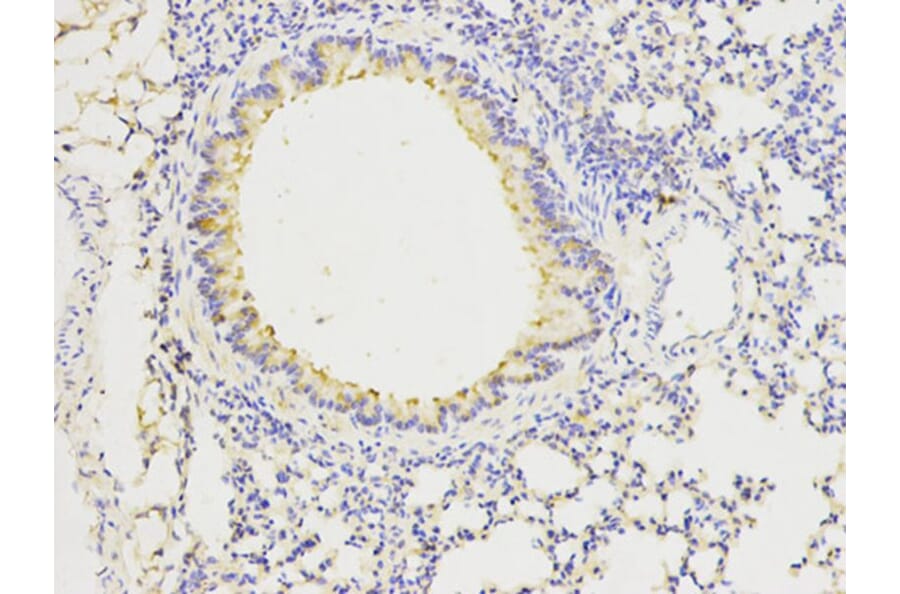 Immunohistochemistry - FGFR1 Antibody from Signalway Antibody (32585) - Antibodies.com