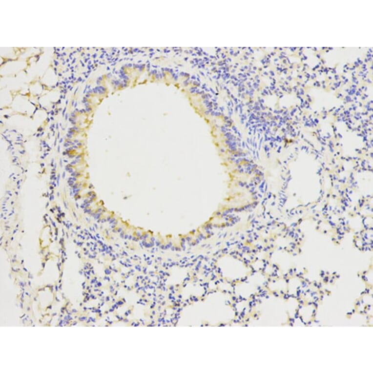 Immunohistochemistry - FGFR1 Antibody from Signalway Antibody (32585) - Antibodies.com