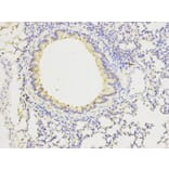 Immunohistochemistry - FGFR1 Antibody from Signalway Antibody (32585) - Antibodies.com