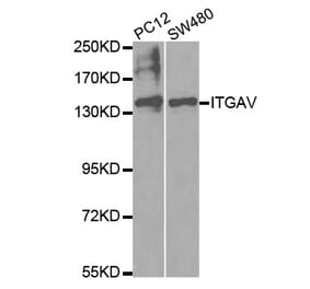 Western blot - ITGAV Antibody from Signalway Antibody (32595) - Antibodies.com