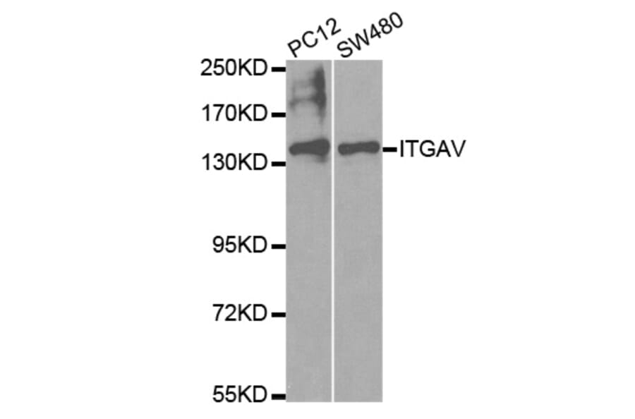 Western blot - ITGAV Antibody from Signalway Antibody (32595) - Antibodies.com