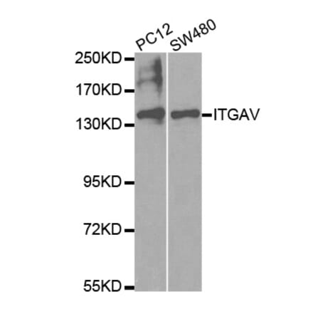 Western blot - ITGAV Antibody from Signalway Antibody (32595) - Antibodies.com