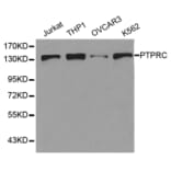 Western blot - PTPRC Antibody from Signalway Antibody (32607) - Antibodies.com