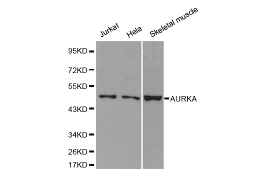 Western blot - AURKA Antibody from Signalway Antibody (32611) - Antibodies.com