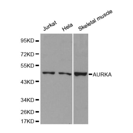 Western blot - AURKA Antibody from Signalway Antibody (32611) - Antibodies.com