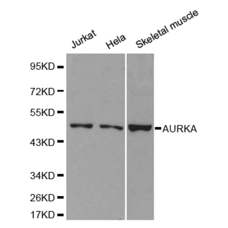 Western blot - AURKA Antibody from Signalway Antibody (32611) - Antibodies.com