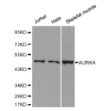 Western blot - AURKA Antibody from Signalway Antibody (32611) - Antibodies.com