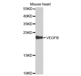 Western blot - VEGFB Antibody from Signalway Antibody (32616) - Antibodies.com