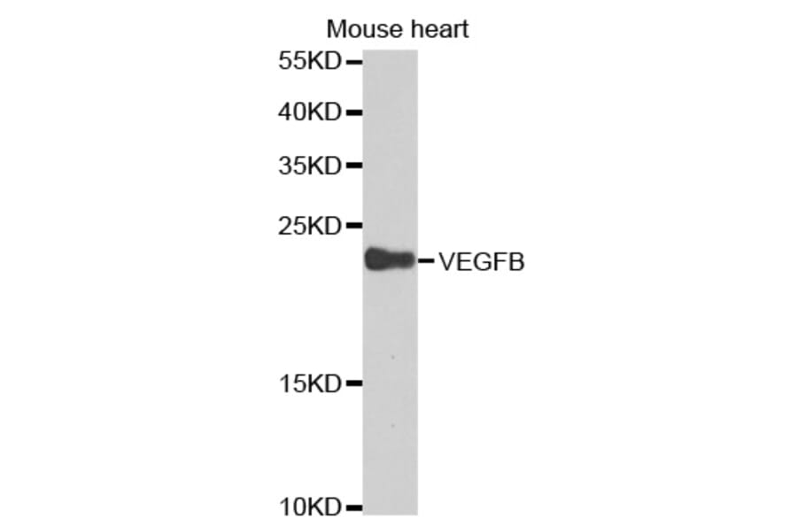 Western blot - VEGFB Antibody from Signalway Antibody (32616) - Antibodies.com