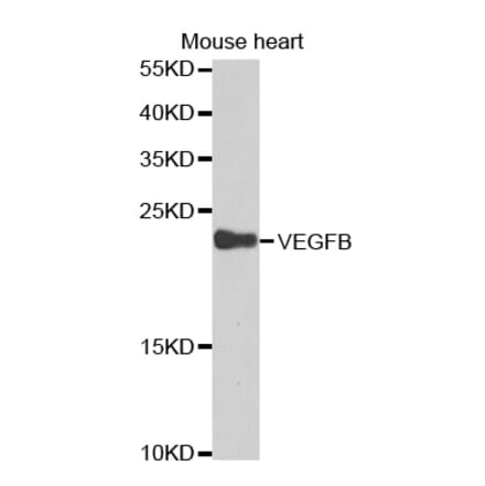 Western blot - VEGFB Antibody from Signalway Antibody (32616) - Antibodies.com