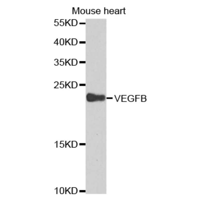 Western blot - VEGFB Antibody from Signalway Antibody (32616) - Antibodies.com