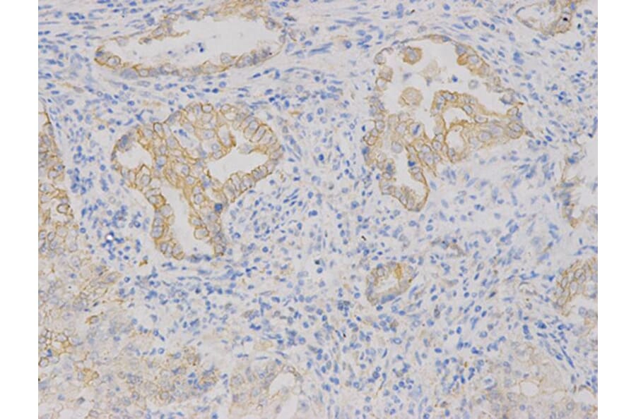 Immunohistochemistry - VEGFB Antibody from Signalway Antibody (32616) - Antibodies.com