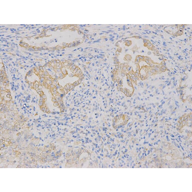 Immunohistochemistry - VEGFB Antibody from Signalway Antibody (32616) - Antibodies.com