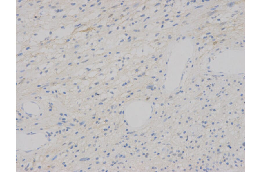 Immunohistochemistry - VEGFB Antibody from Signalway Antibody (32616) - Antibodies.com