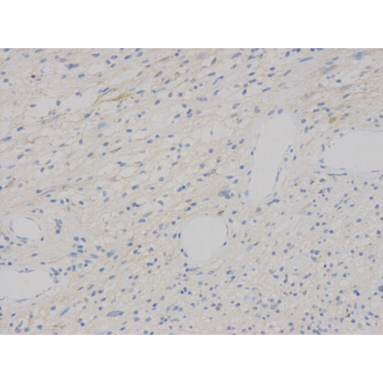 Immunohistochemistry - VEGFB Antibody from Signalway Antibody (32616) - Antibodies.com