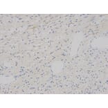 Immunohistochemistry - VEGFB Antibody from Signalway Antibody (32616) - Antibodies.com