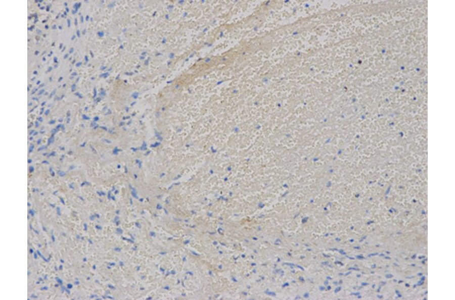 Immunohistochemistry - VEGFB Antibody from Signalway Antibody (32616) - Antibodies.com