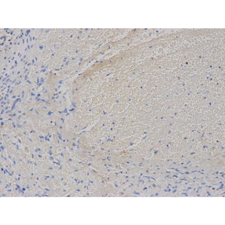 Immunohistochemistry - VEGFB Antibody from Signalway Antibody (32616) - Antibodies.com
