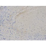 Immunohistochemistry - VEGFB Antibody from Signalway Antibody (32616) - Antibodies.com