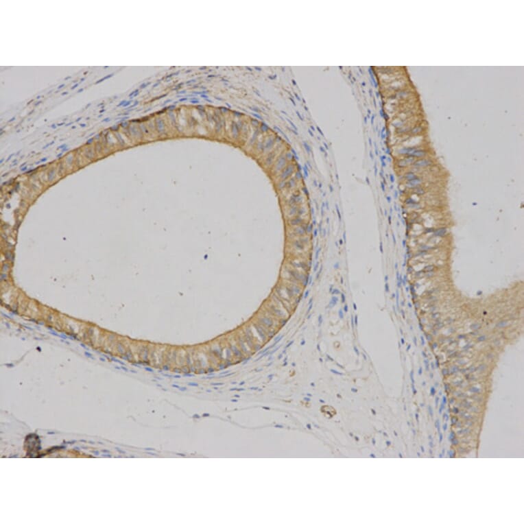Immunohistochemistry - VEGFB Antibody from Signalway Antibody (32616) - Antibodies.com