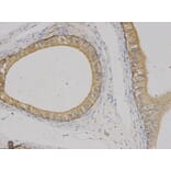 Immunohistochemistry - VEGFB Antibody from Signalway Antibody (32616) - Antibodies.com