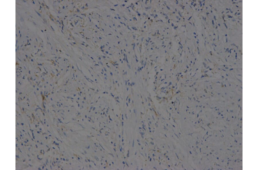 Immunohistochemistry - VEGFB Antibody from Signalway Antibody (32616) - Antibodies.com
