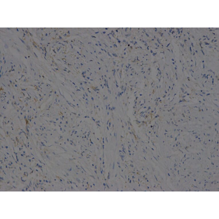 Immunohistochemistry - VEGFB Antibody from Signalway Antibody (32616) - Antibodies.com