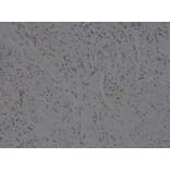 Immunohistochemistry - VEGFB Antibody from Signalway Antibody (32616) - Antibodies.com