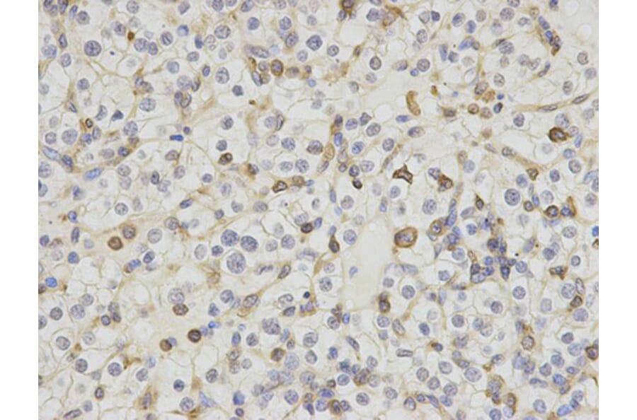 Immunohistochemistry - HCLS1 Antibody from Signalway Antibody (32635) - Antibodies.com