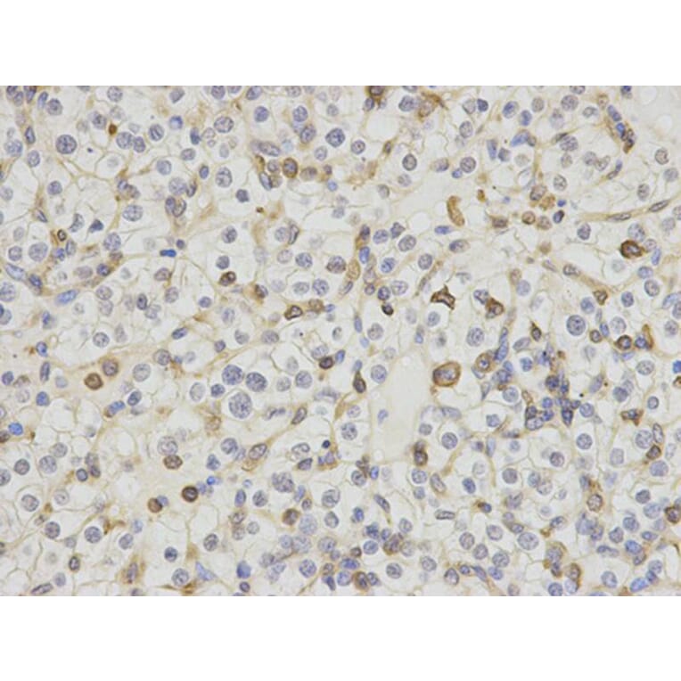 Immunohistochemistry - HCLS1 Antibody from Signalway Antibody (32635) - Antibodies.com