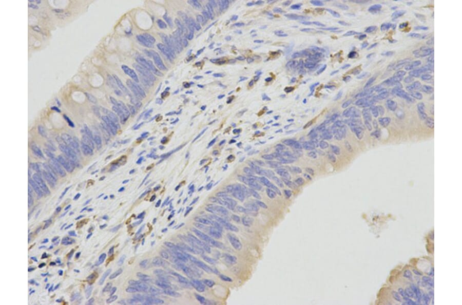 Immunohistochemistry - HCLS1 Antibody from Signalway Antibody (32635) - Antibodies.com