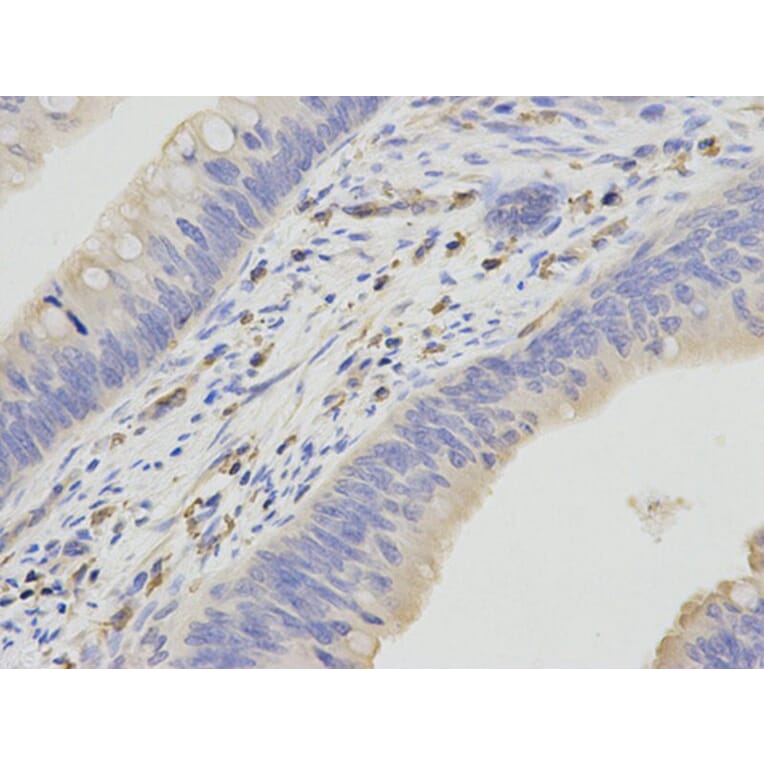 Immunohistochemistry - HCLS1 Antibody from Signalway Antibody (32635) - Antibodies.com